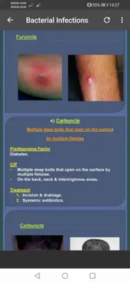 All Skin Infections &Treatment android App screenshot 1