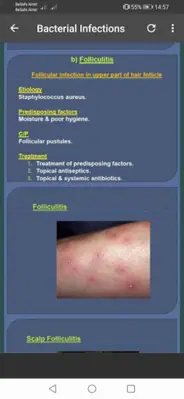 All Skin Infections &Treatment android App screenshot 2