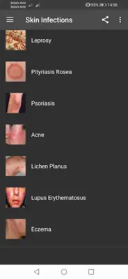 All Skin Infections &Treatment android App screenshot 4